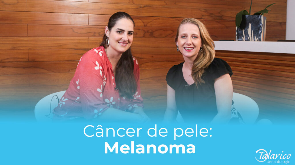 O melanoma é um tipo de câncer de pele muito agressivo, mas que tem altas chances de cura, se for detectado no início.